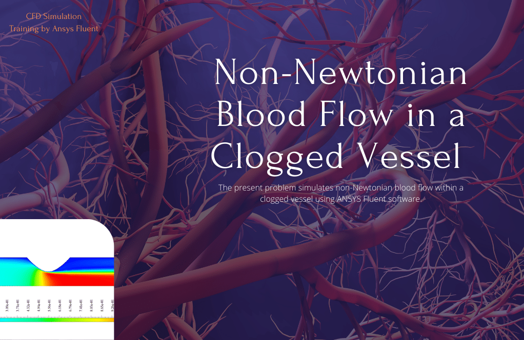 Blood Flow in Clogged Artery CFD Simulation by ANSYS Fluent Training - MR  CFD