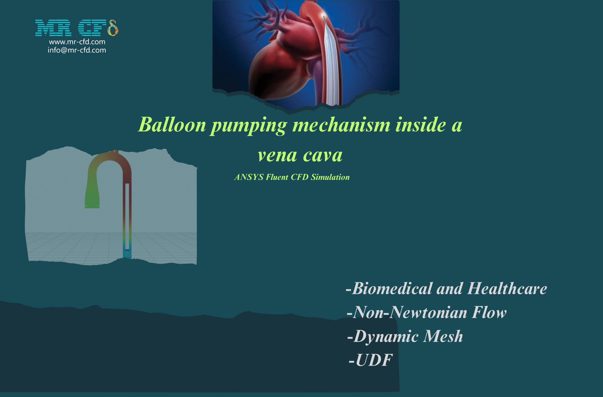 balloon pumping mechanism inside a vena cava