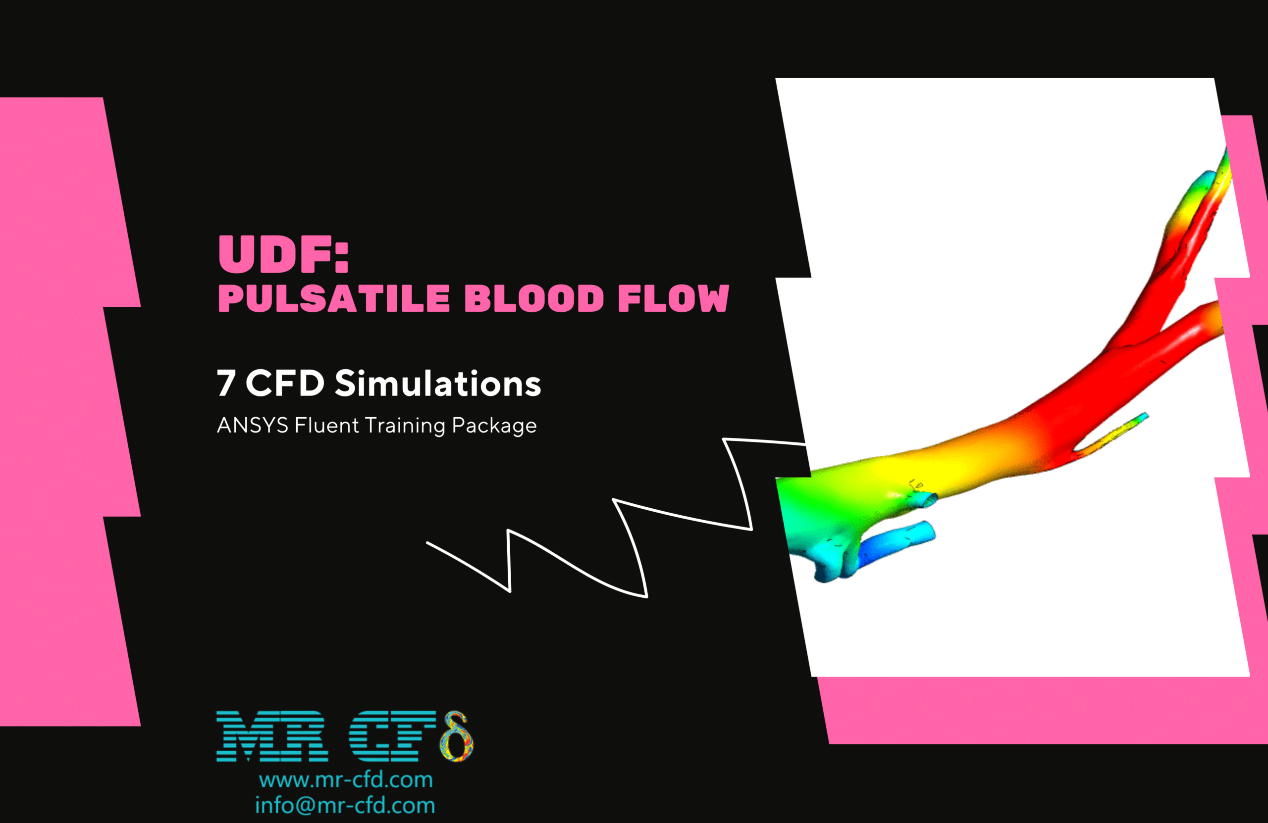 UDF Application for Pulsatile Blood Flow modeling by ANSYS Fluent: Training Package, 7 CFD Simulations